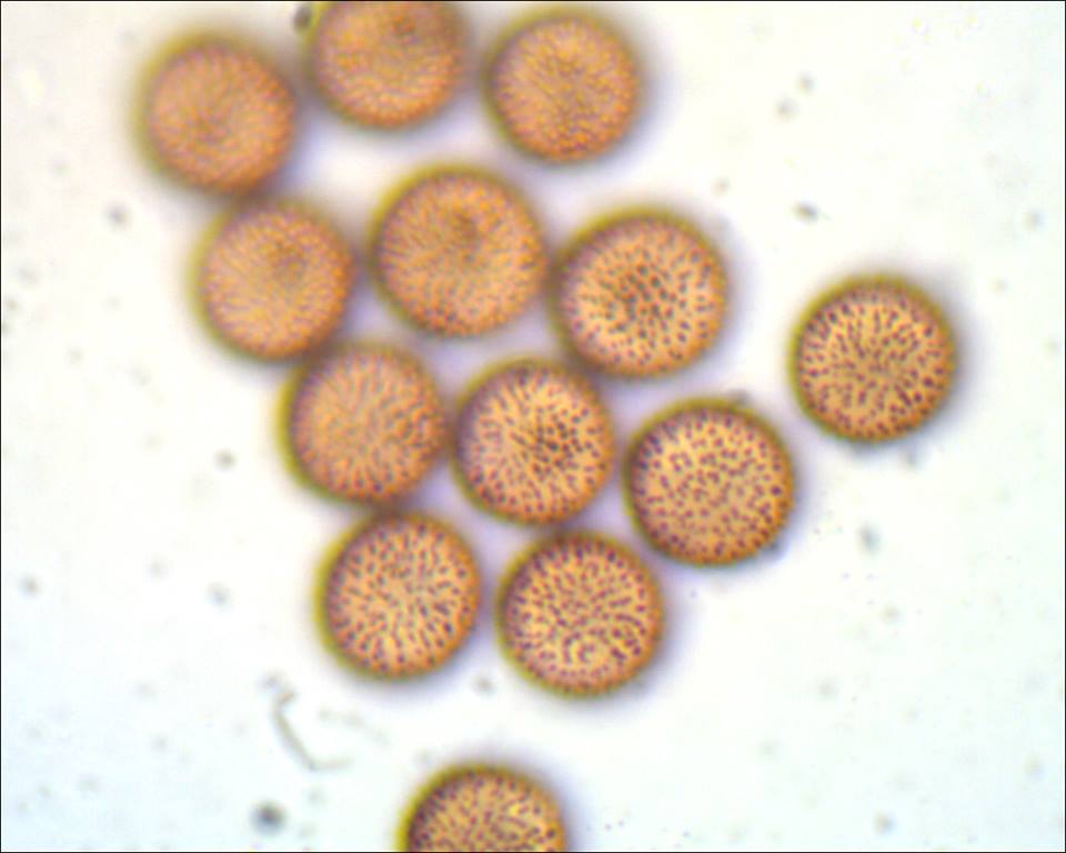 Badhamia foliicola??